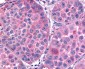 FZD7 / Frizzled 7 Antibody (N-Terminus)